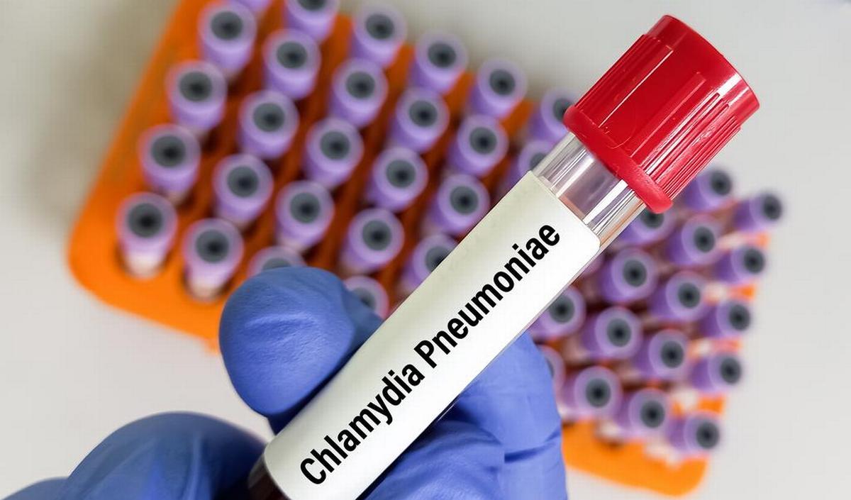 Chlamydia Pneumoniae