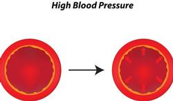 Blood vessels expansions